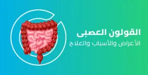 متلازمة القولون العصبي