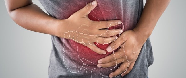 متلازمة القولون العصبي: الأسباب، الأعراض، والعلاج 3 أعراض متلازمة القولون العصبي