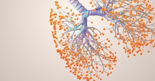 أمراض الجهاز التنفسي عند كبار السن - الأمراض الشائعة 5 أسباب زيادة انتشار أمراض الجهاز التنفسي عند كبار السن
